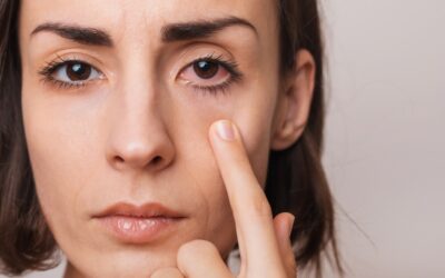 Can Dry Eye Get Better on Its Own?