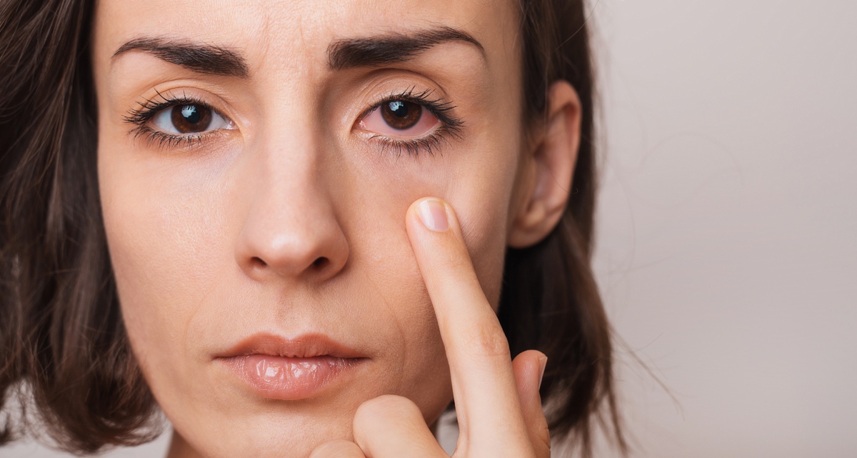 Can Dry Eye Get Better on Its Own? Walter Eye Clinic